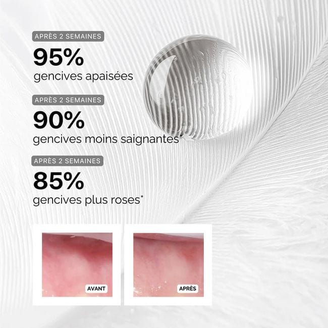 serum-gencives-regenerant-intense-the-smilist-2